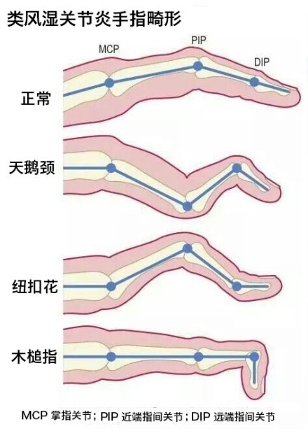 79054f1715e3ce383d066d41b652c88b42b3139ad800-nxQw1T_fw658.jp