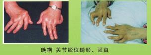 [CropImg]2eec1919a0fd5428a0e0c389cb7a0bc3.jpg