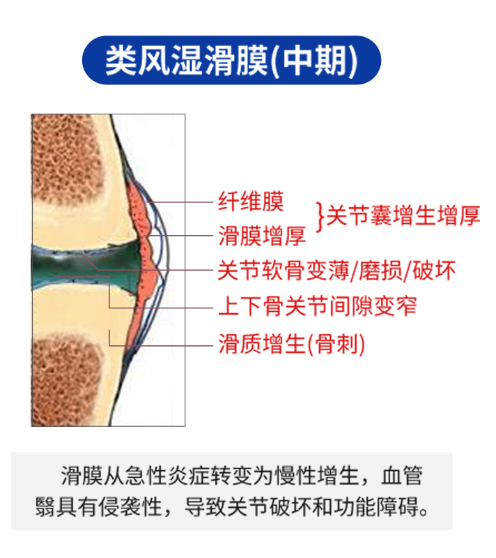 4b0a44431440adf97f41f328c321e8e6.jpg