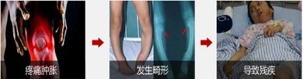 成都风湿病专科医院